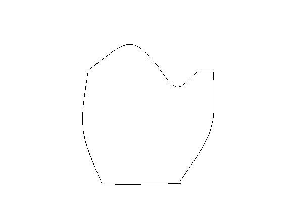 ärmel2