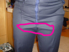 Hose wirft Falten!!