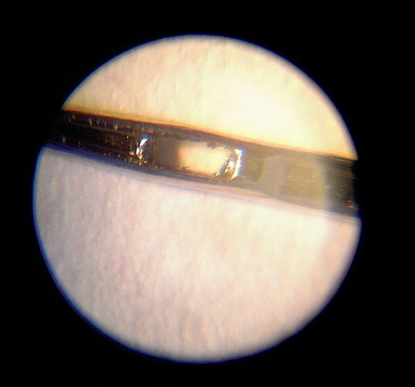 nadel2